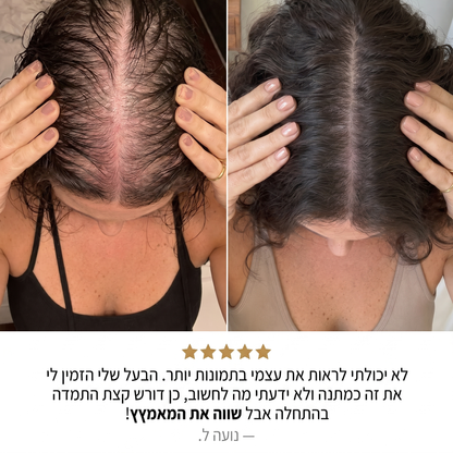 RootFix™ | ערכה לטיפול בנשירה והתקרחות של השיער