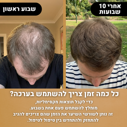 RootFix™ | ערכה לטיפול בנשירה והתקרחות של השיער