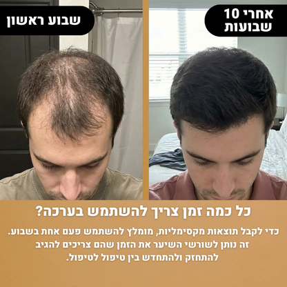 ערכה לשיקום וצמיחה מחודשת של השיער - RootFix