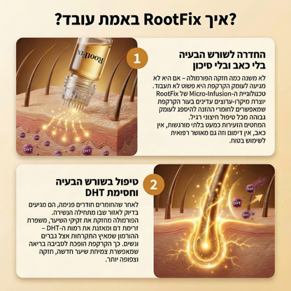 RootFix - ערכה לטיפול בנשירה והתקרחות של השיער