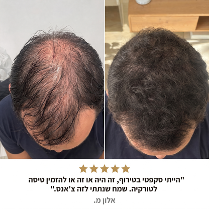 RootFix™ | ערכה לטיפול בנשירה והתקרחות של השיער